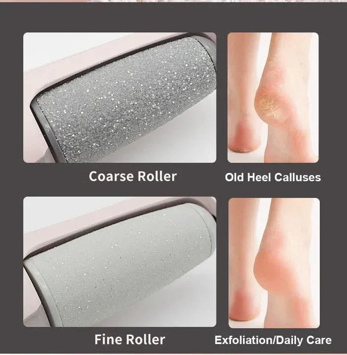 Foot File Callus